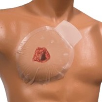 Halo Seals 2 ks - hrudní krytí bez ventilu